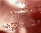 optochin test with pneumococcus